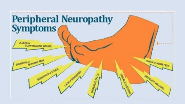 Diabetic Neuropathy